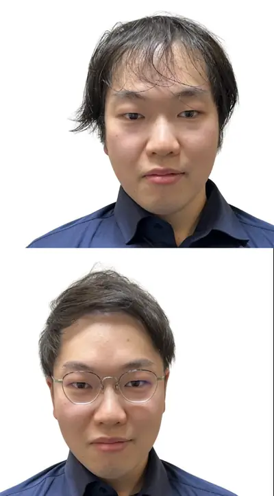 M型禿 × 上梳瀏海｜RELIVE JAPAN 頭髮稀疏專門剪髮案例