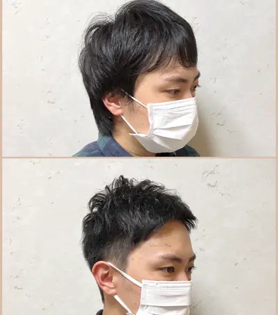 M型禿 × 頭髮稀疏專門剪髮｜RELIVE JAPAN 頭髮稀疏專門剪髮案例