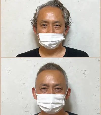 整體稀疏 × 超短髮｜RELIVE JAPAN 頭髮稀疏專門剪髮案例