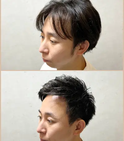 M型禿（透光瀏海） × 上梳瀏海｜RELIVE JAPAN 頭髮稀疏專門剪髮案例