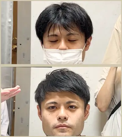 地中海禿 × 上梳瀏海｜RELIVE JAPAN 頭髮稀疏專門剪髮案例