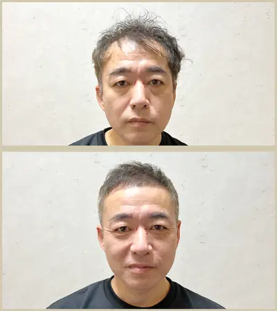 M型禿 × 超短髮｜RELIVE JAPAN 頭髮稀疏專門剪髮案例