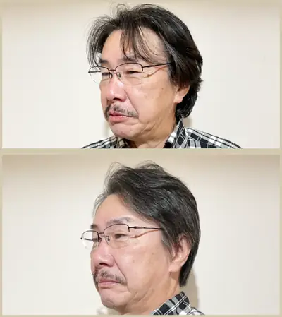 M型禿（透光瀏海） × 頭髮稀疏專門剪髮｜RELIVE JAPAN 頭髮稀疏專門剪髮案例