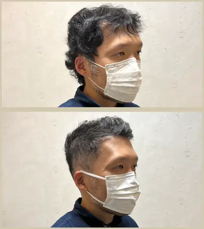M型禿 × 頭髮稀疏專門剪髮｜RELIVE JAPAN 頭髮稀疏專門剪髮案例